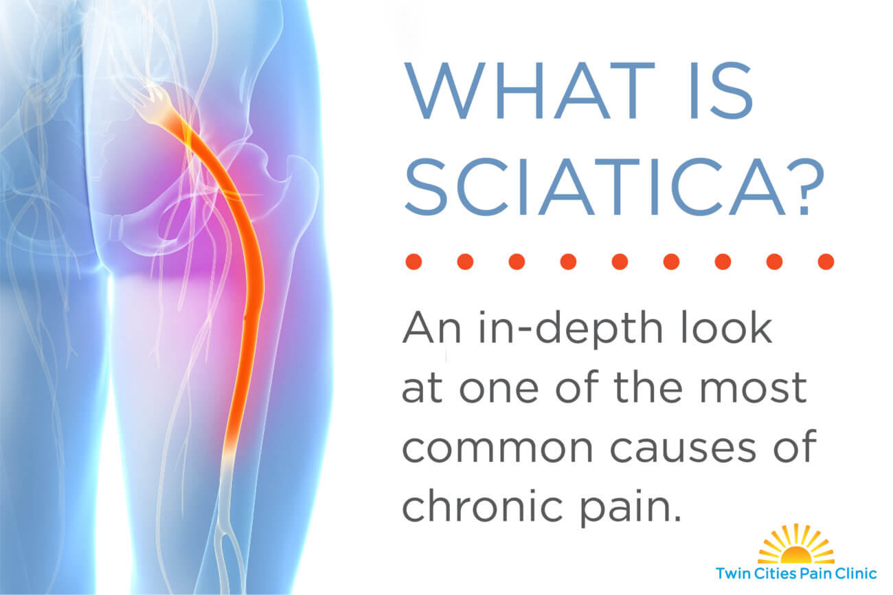 What is sciatica-X-ray image of sciatica nerve glowing red to indicate pain